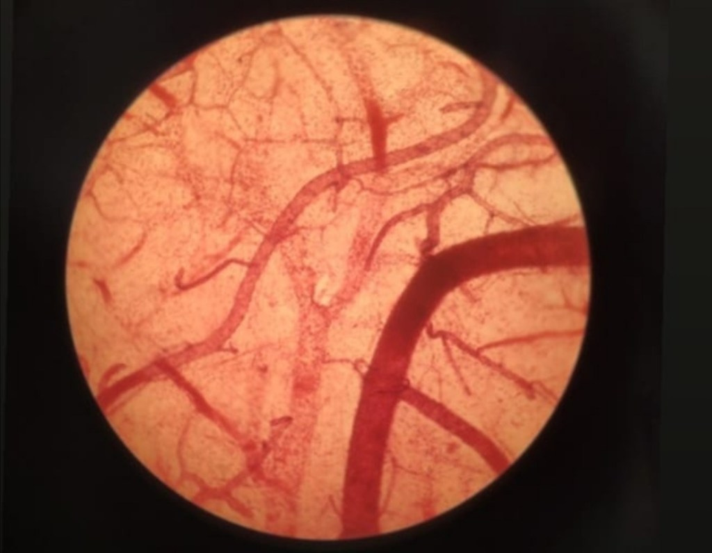 Micrografía cerebral