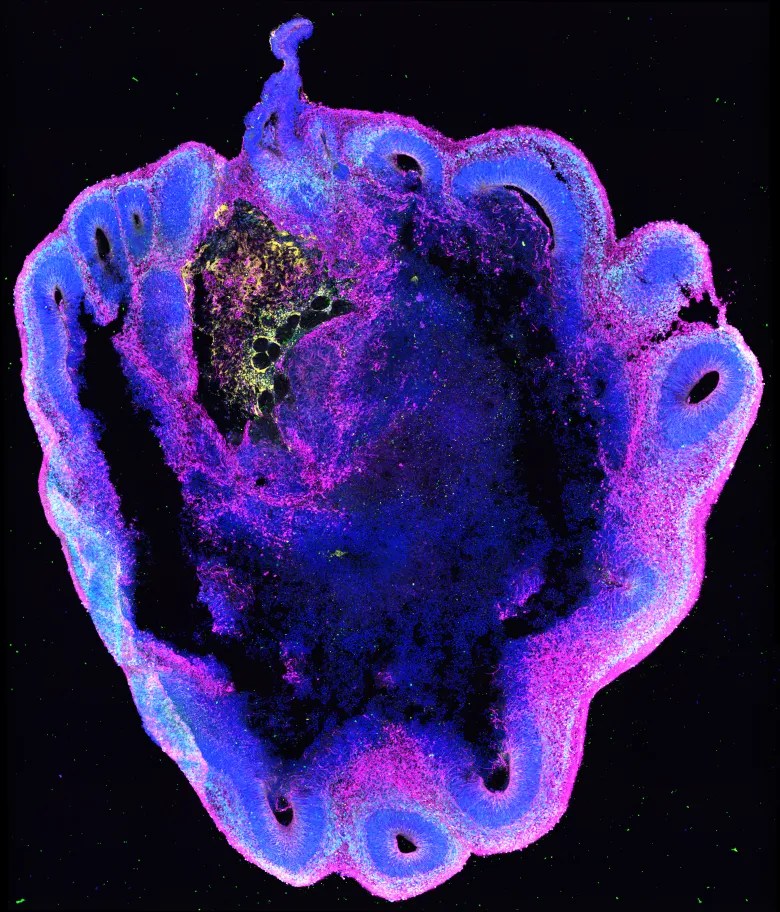 Organoide cerebral fluorescente